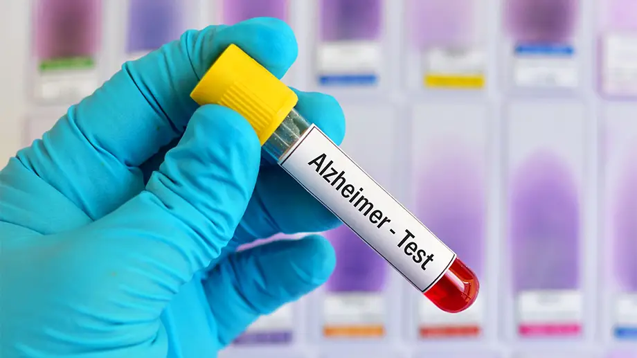 Blood tests for Alzheimer's ? Part 2